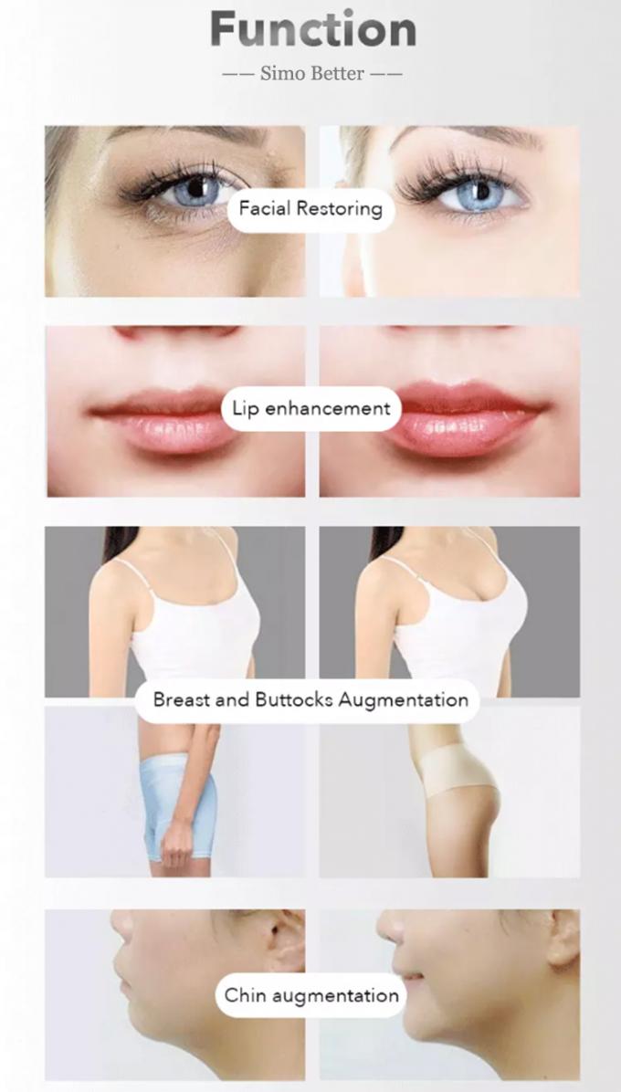FÜLLER-nicht chirurgisches Lippenverbesserungs-Gel Natrium-Hyaluronate injizierbares Haut