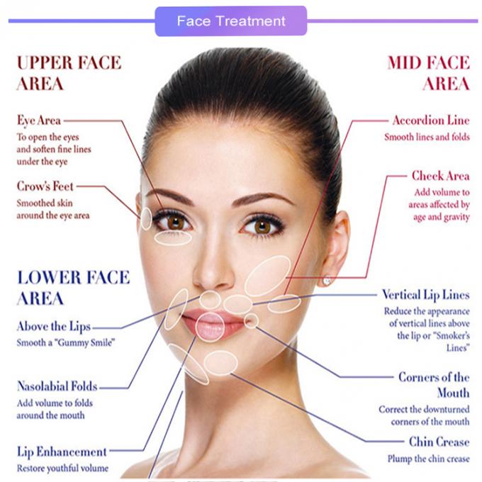 Nicht chirurgische Haut, die das Facelift-Gesicht formt Polydioxanone-Faden verlegt